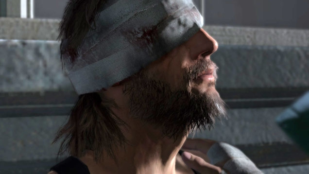 The Phantom Pain: Ist es wirklich Metal Gear Solid 5?